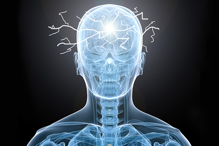 noticia_01-epilepsia